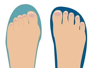 Illustration comparing a narrow shoe outline to a wide toe box shoe outline