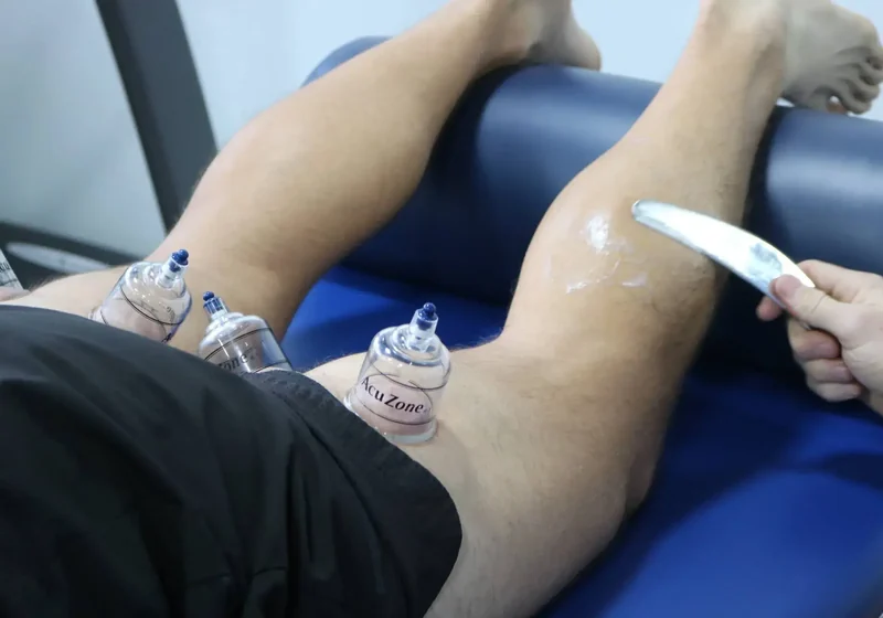 Doctor of Physical Therapy treating a patient&rsquo;s calf with a stainless steel Graston instrument